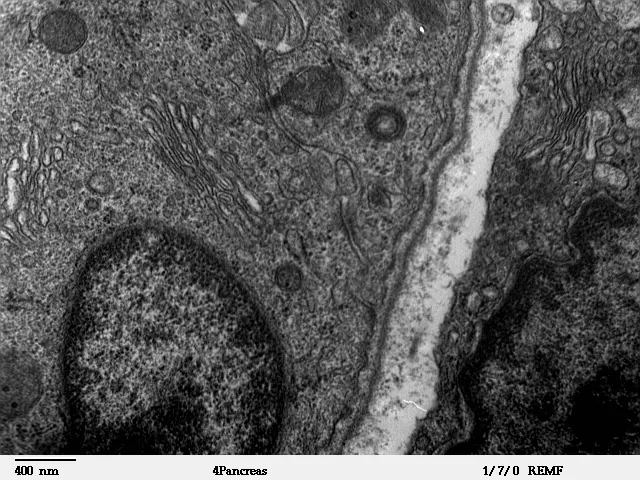 Micrografie: teancuri de membrane curbate lângă un nucleu.