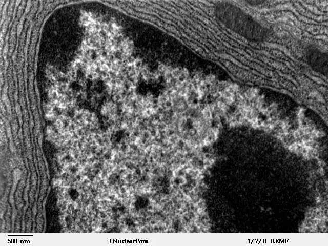 Micrografie alb-negru: un nucleu mare și, lângă el, linii paralele punctate.