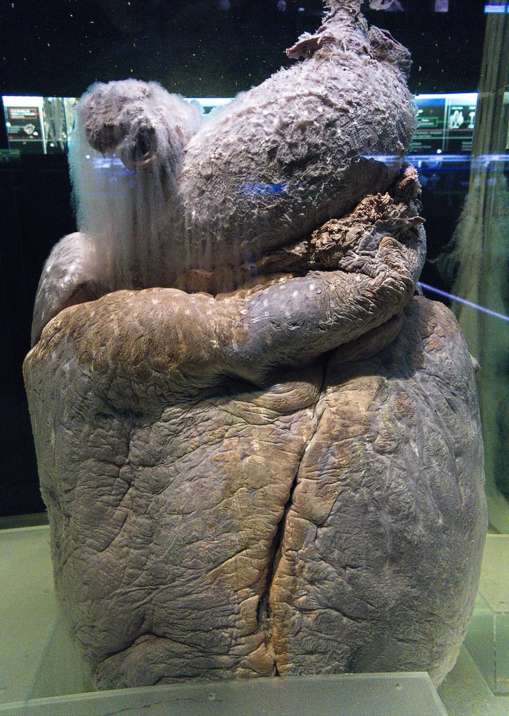 A grey-brown heart of a sei whale on a stand in a glass case, with the stumps of its large vessels at the top.